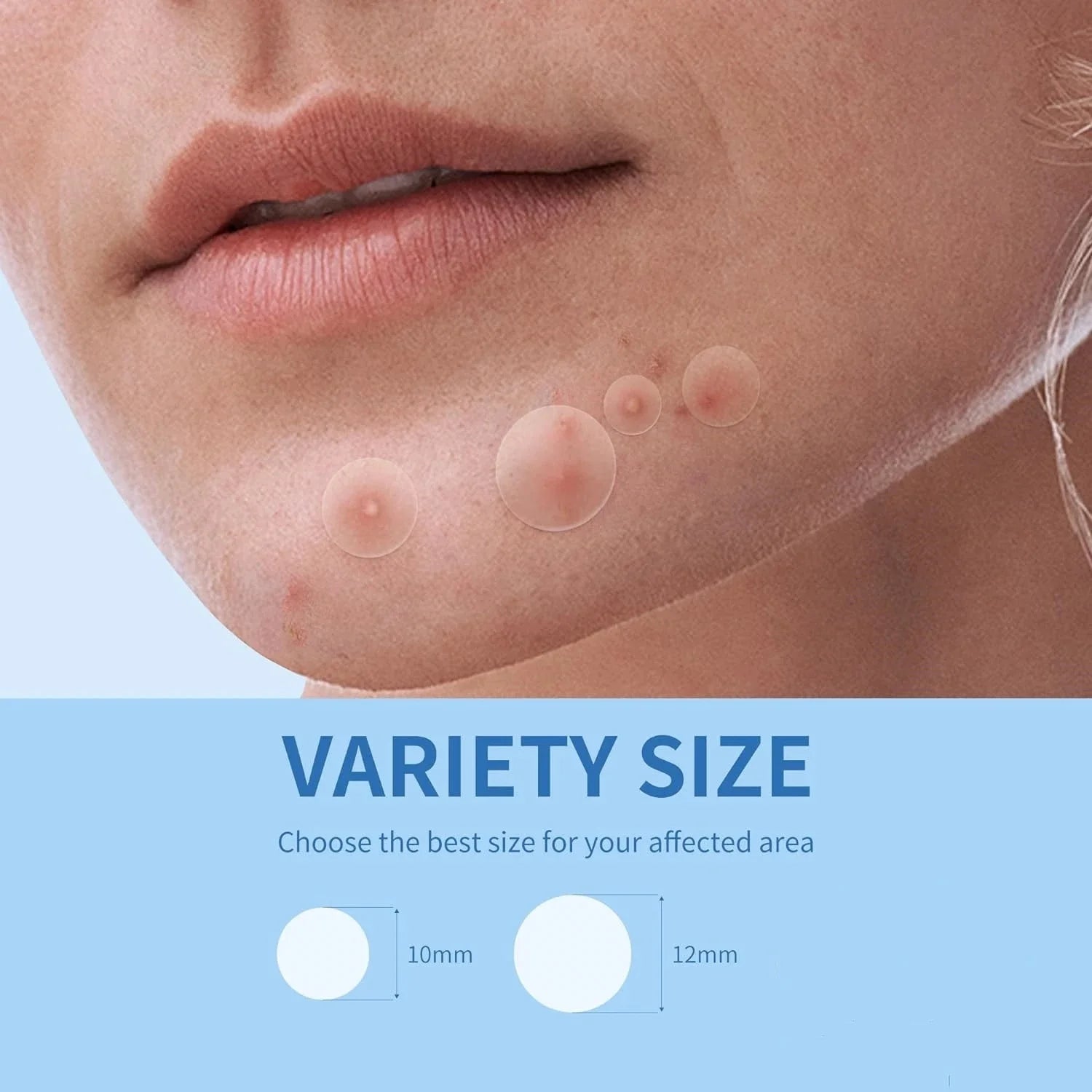 Parches para acné facial Invisible 360pz- cuidado de la piel y curación antiinflamatoria